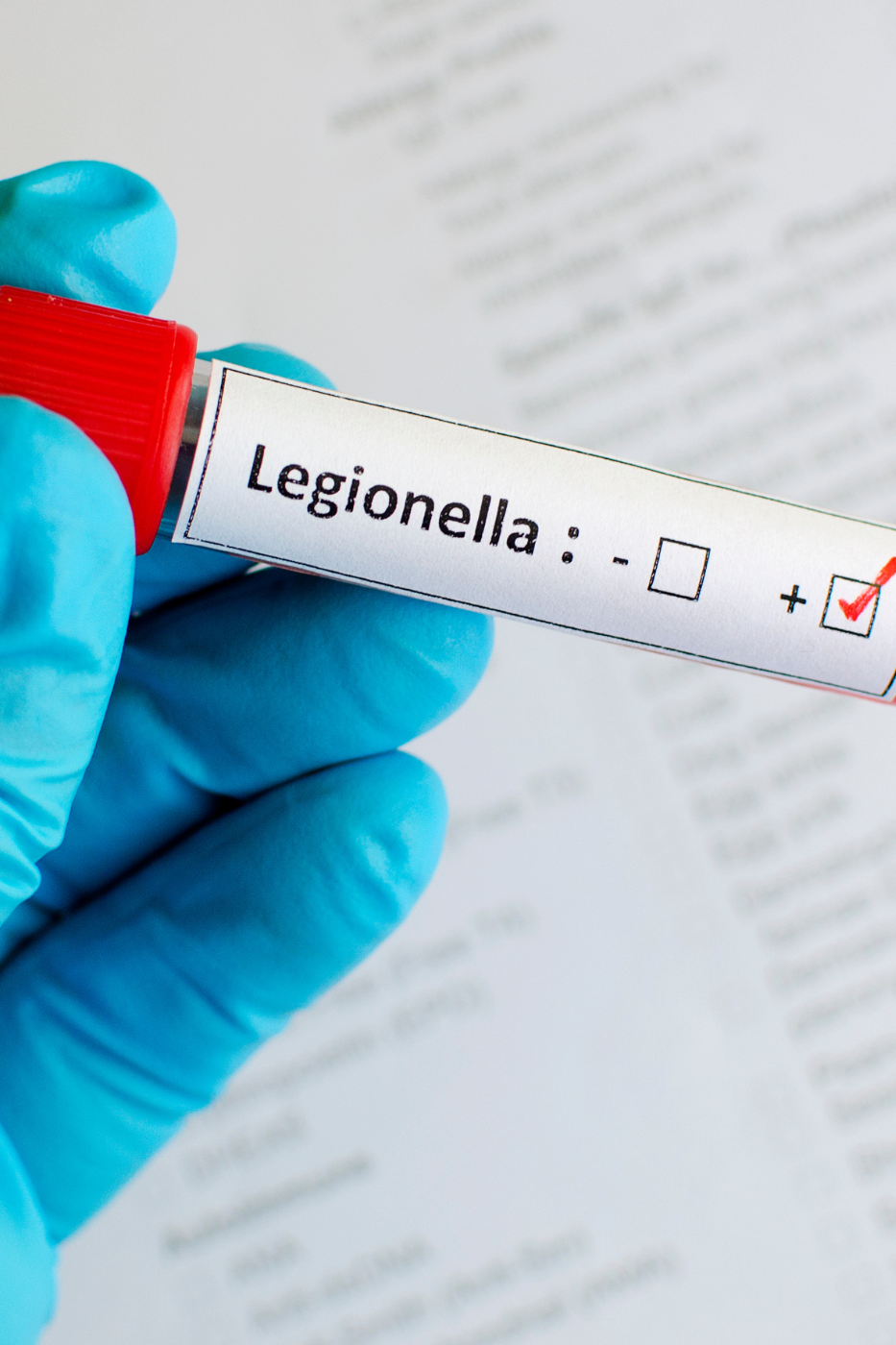 Legionella Curso Legionella